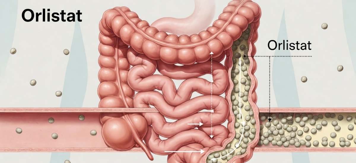 Orlistat per la gestione del peso: cosa sapere prima dell'uso